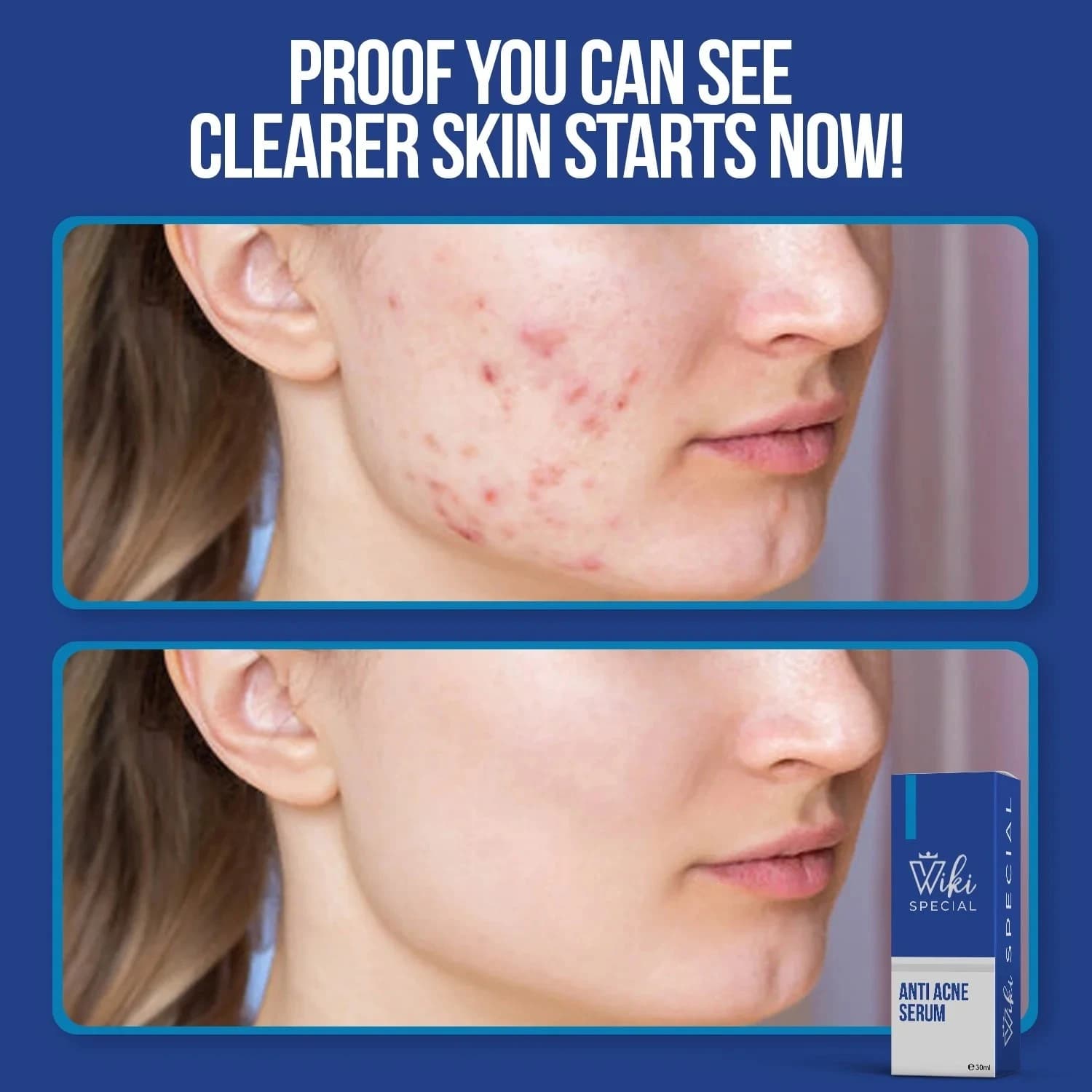 WIKI Facial Serum, 30ml thumbnail 3