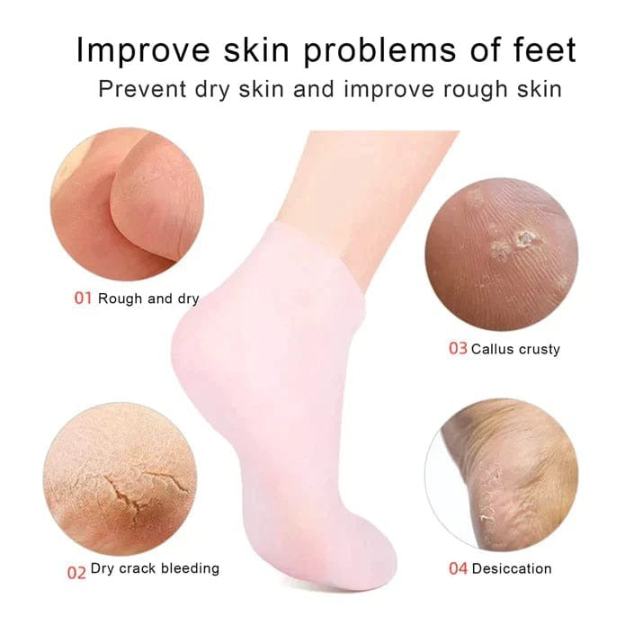 Winter Bundle Silicone Socks+Gloves